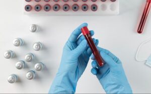 Ciri-Ciri Golongan Darah O yang Membedakan Anda dari yang Lain